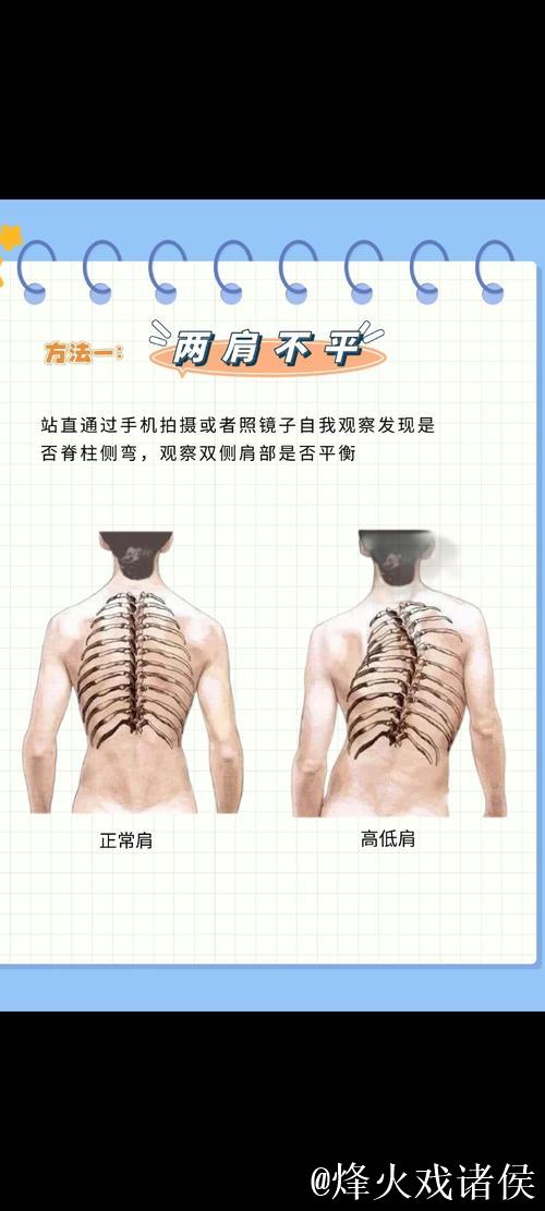 1分钟科普站丨预防青少年脊柱侧弯 这2个动作太管用了